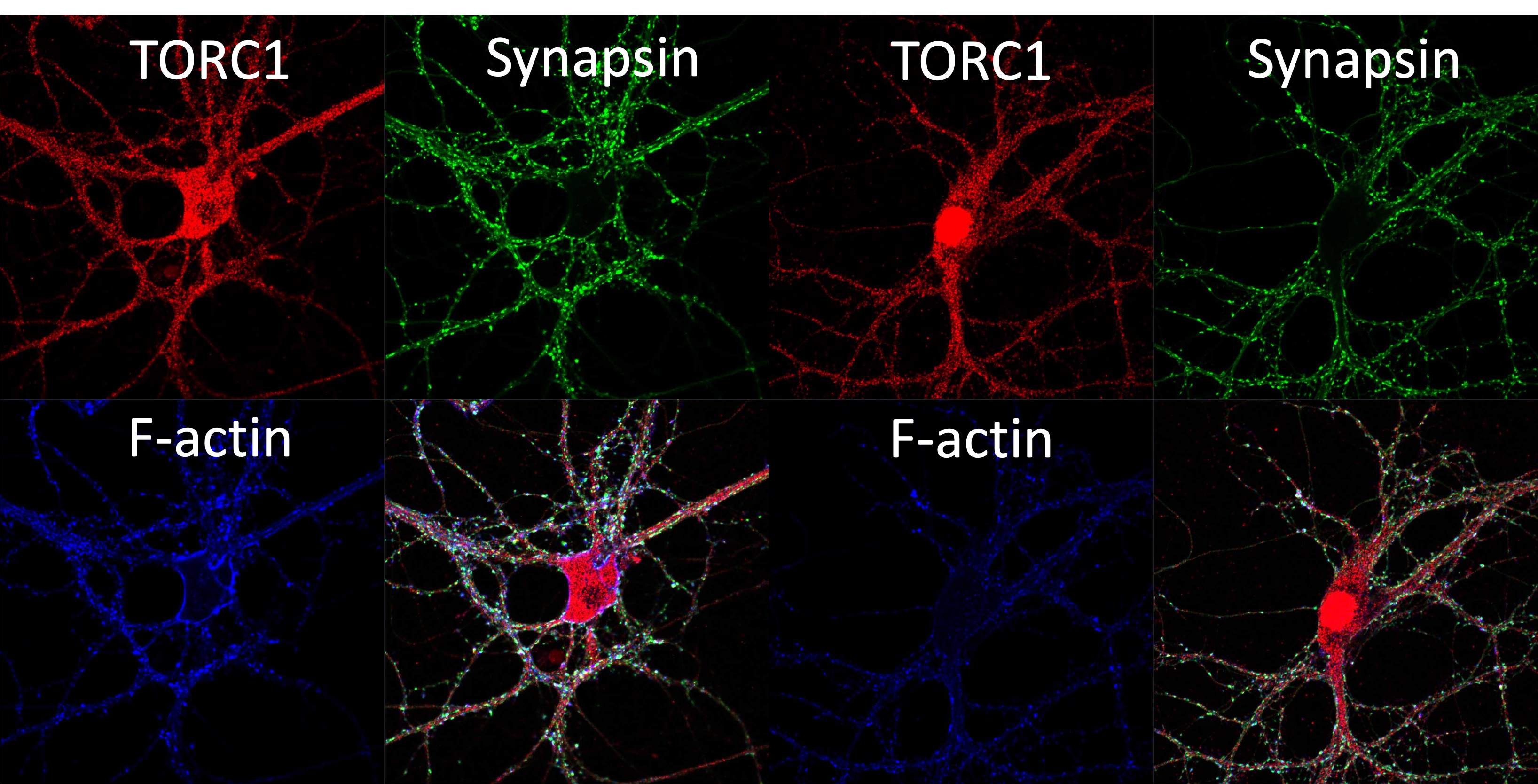 synapse