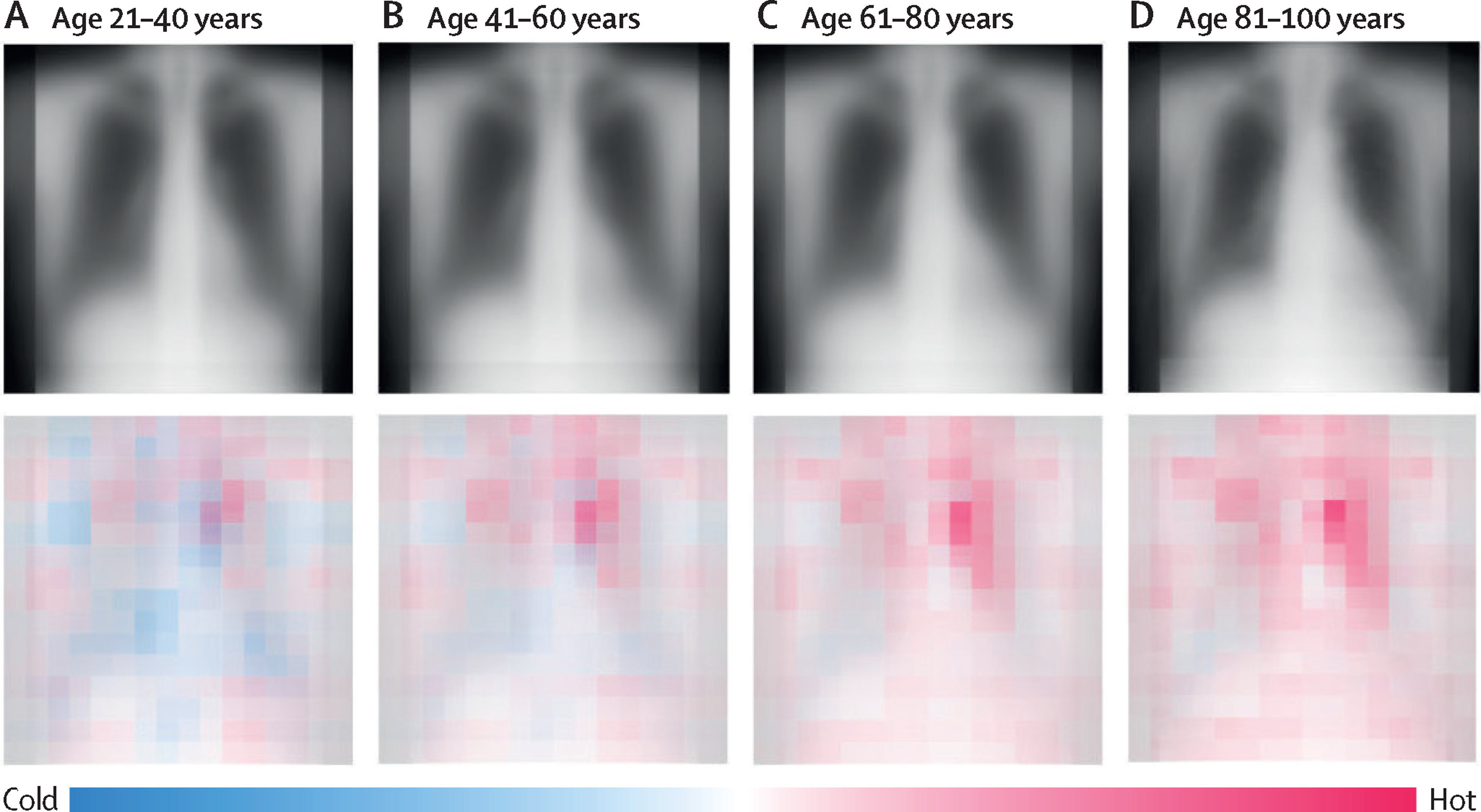 Chest radiography as a biomarker of ageing: artificial intelligence-based, multi-institutional model development and validation in Japan