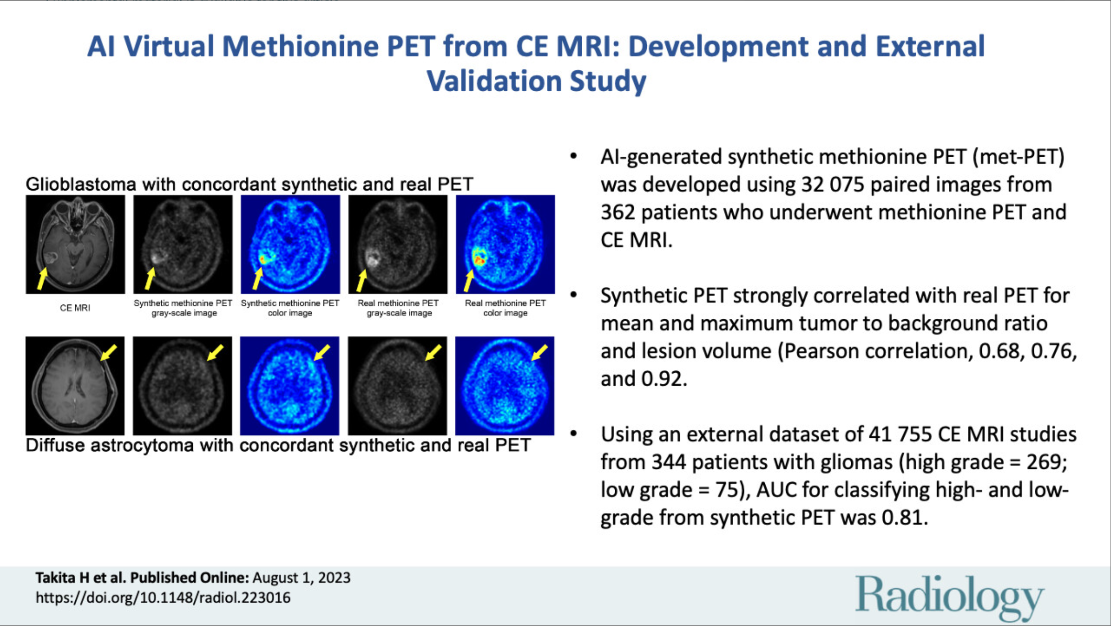 AI-based Virtual Synthesis of Methionine PET from Contrast-enhanced MRI: Development and External Validation Study